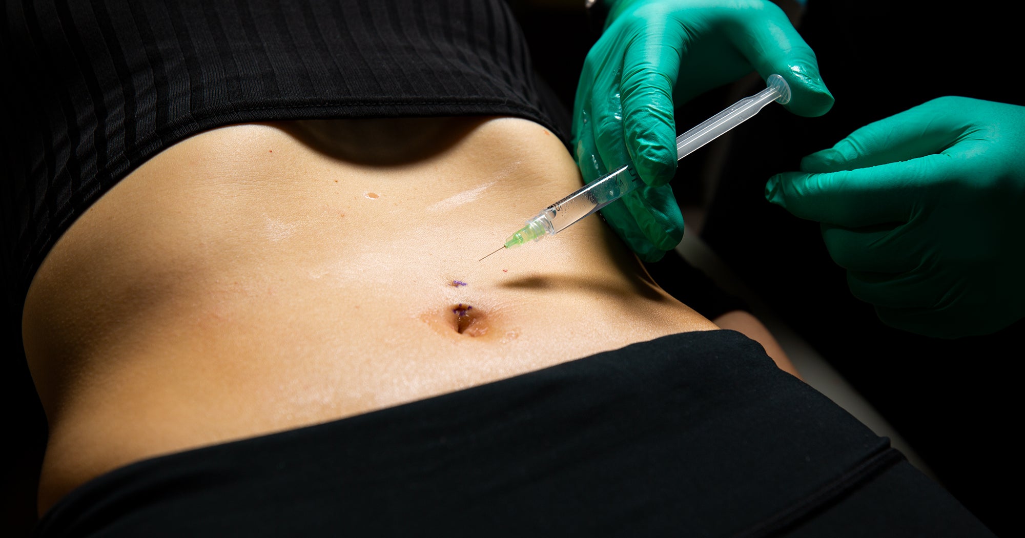 Navel & Belly Piercing Guide: Everything You Need to Know – FreshTrends