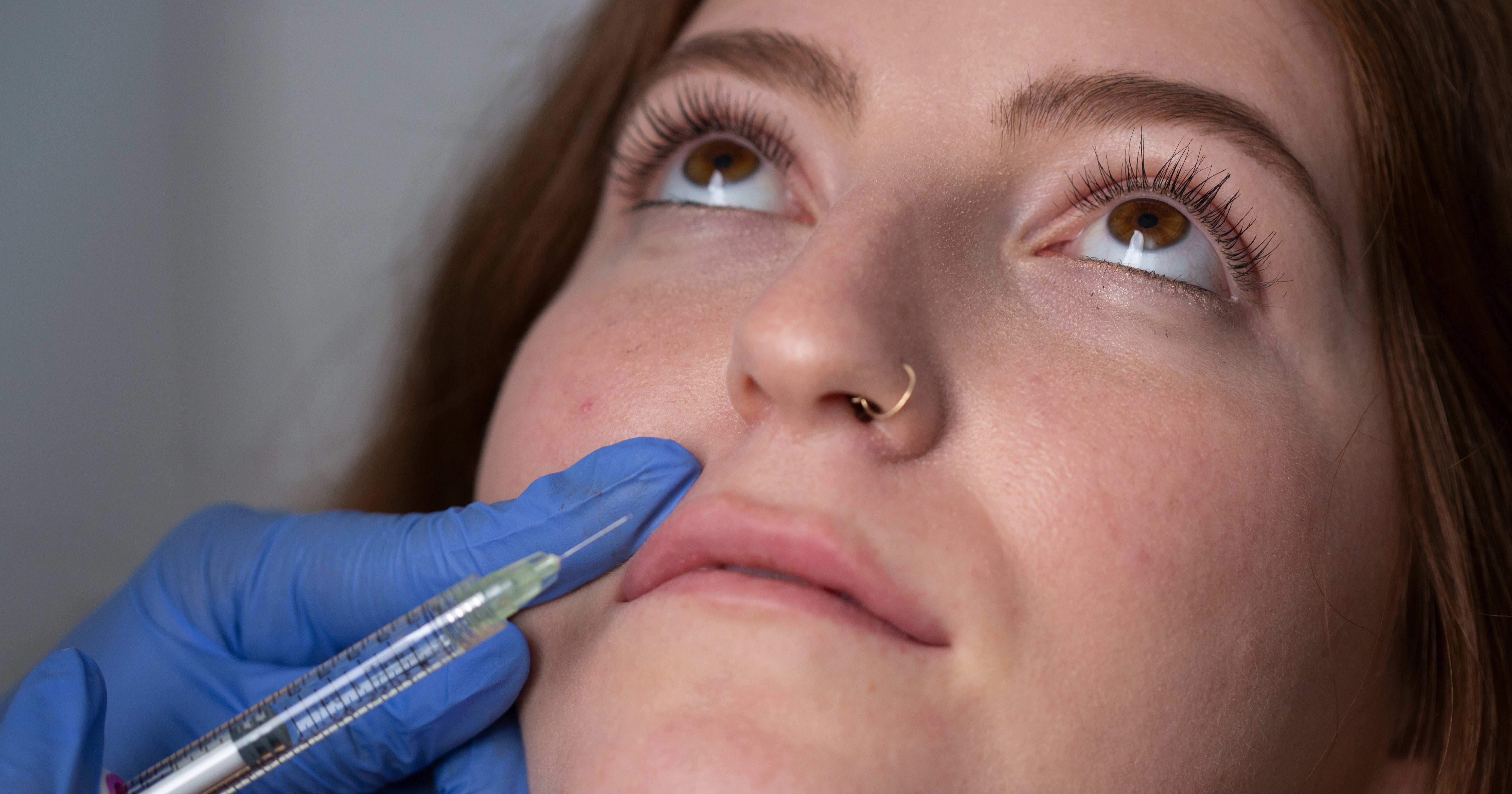 Lip Injection Before & After Photo Results Full Video