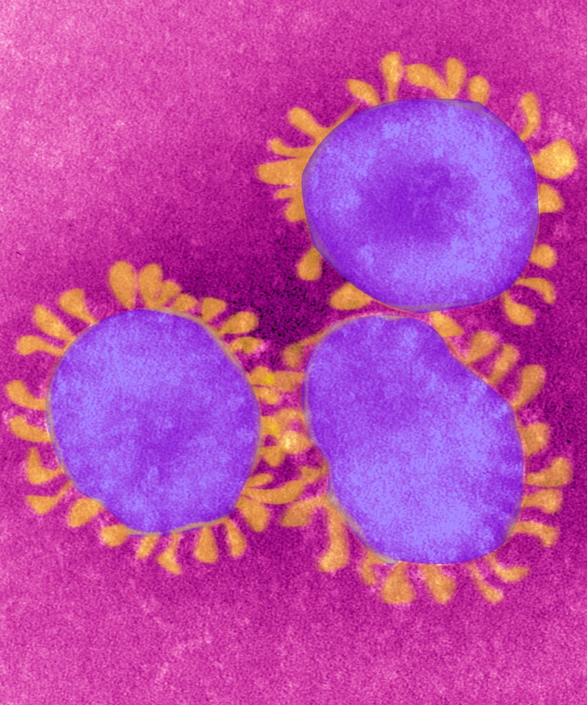 What You Need To Know About The New COVID-19 “Super Strain” New COVID-19 Super Strain