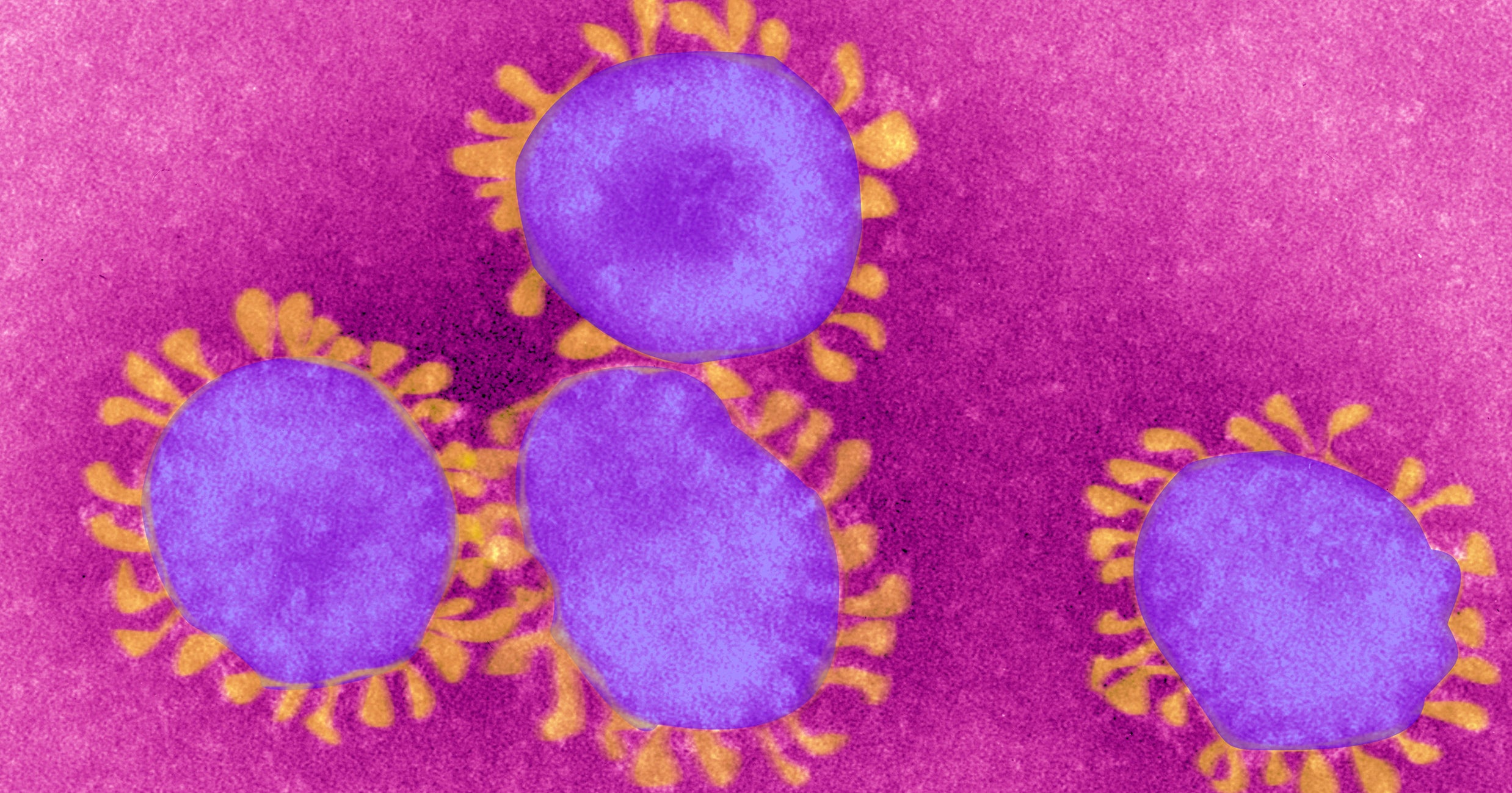 What New Mutant COVID Strain In New York Means