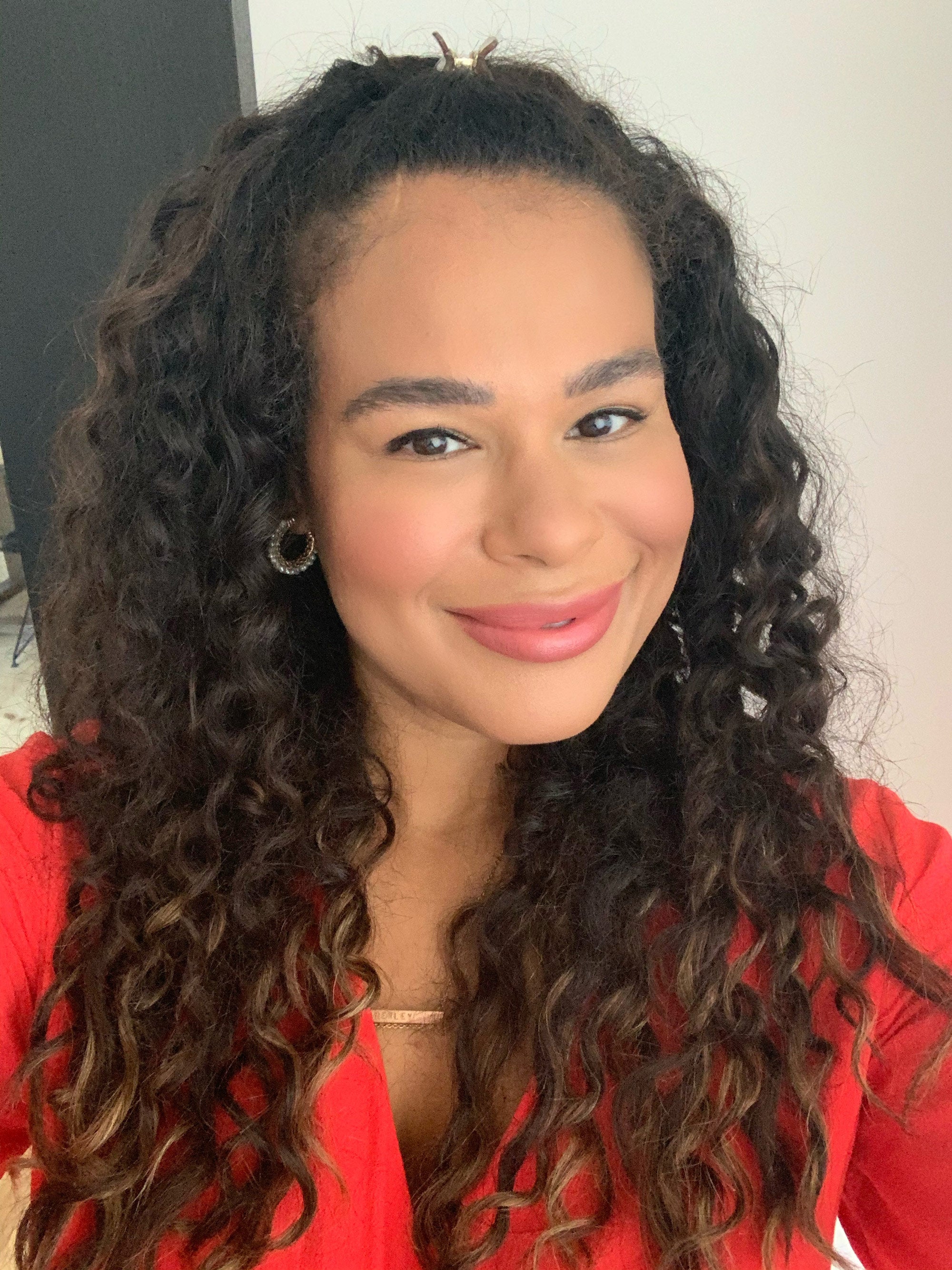 Hair Loss Solutions For Black Women & Afro Hair Hair Loss Solutions For Black Women & Afro Hair