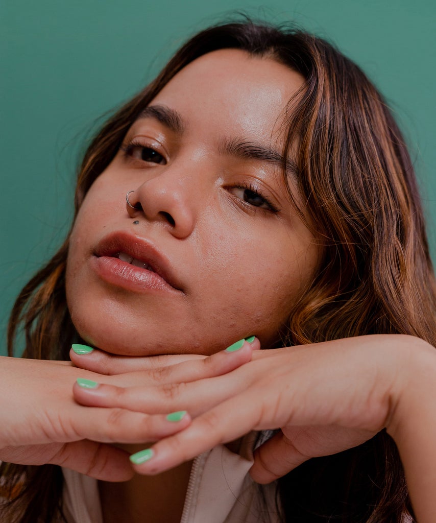 What Is Stress Acne Stress Acne