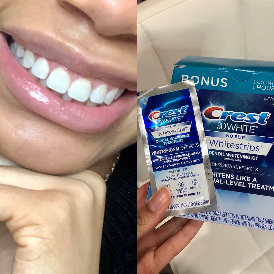 Best Teeth Whitening Products Reviews 2021