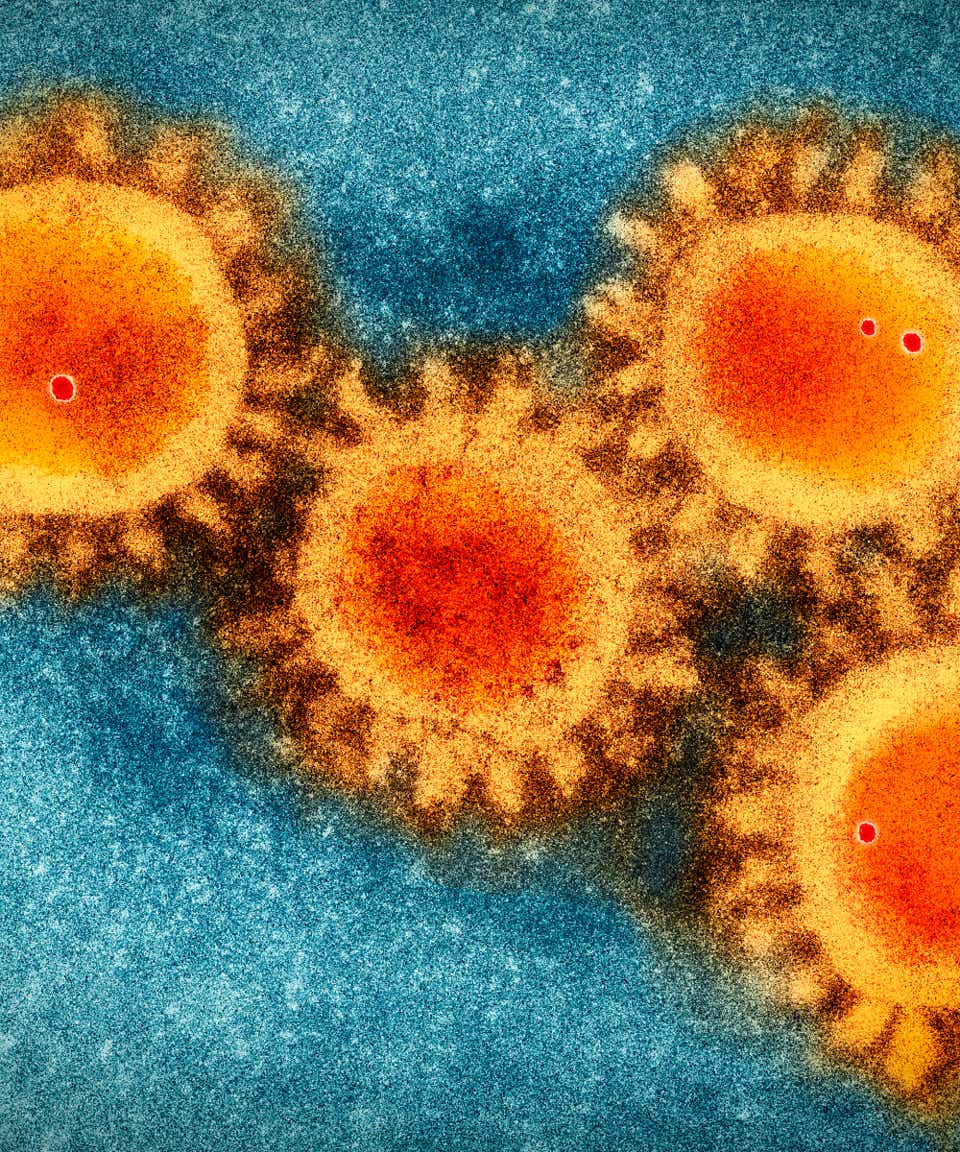 Colored visualisation of electron microscopy photo of the coronavirus COVID-19