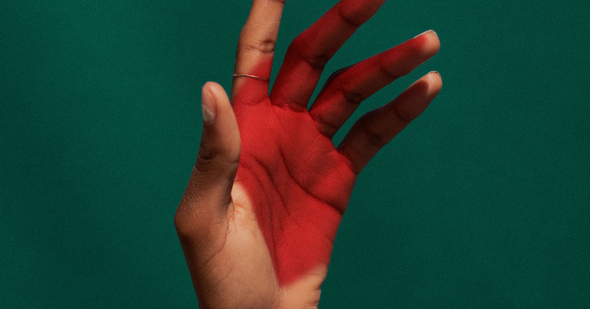 Why Raynaud's Disease Numb Fingers Affects Young Women