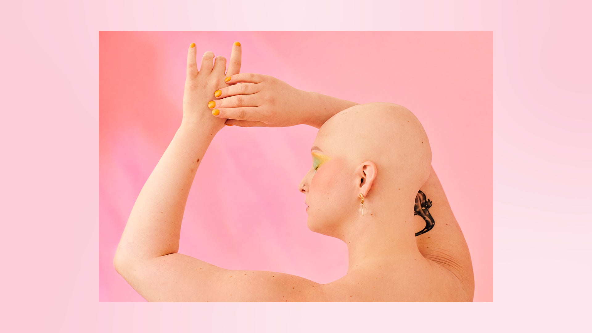 Vivendo com alopecia: por que nossa queda de cabelo não nos define