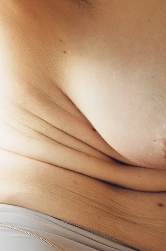 Close up shot of Sophie the photographer's textured skin.