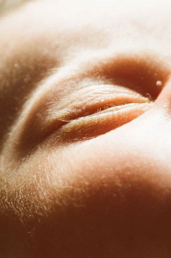 Close up shot of Sophie's baby's face. Her eye is closed against the light.