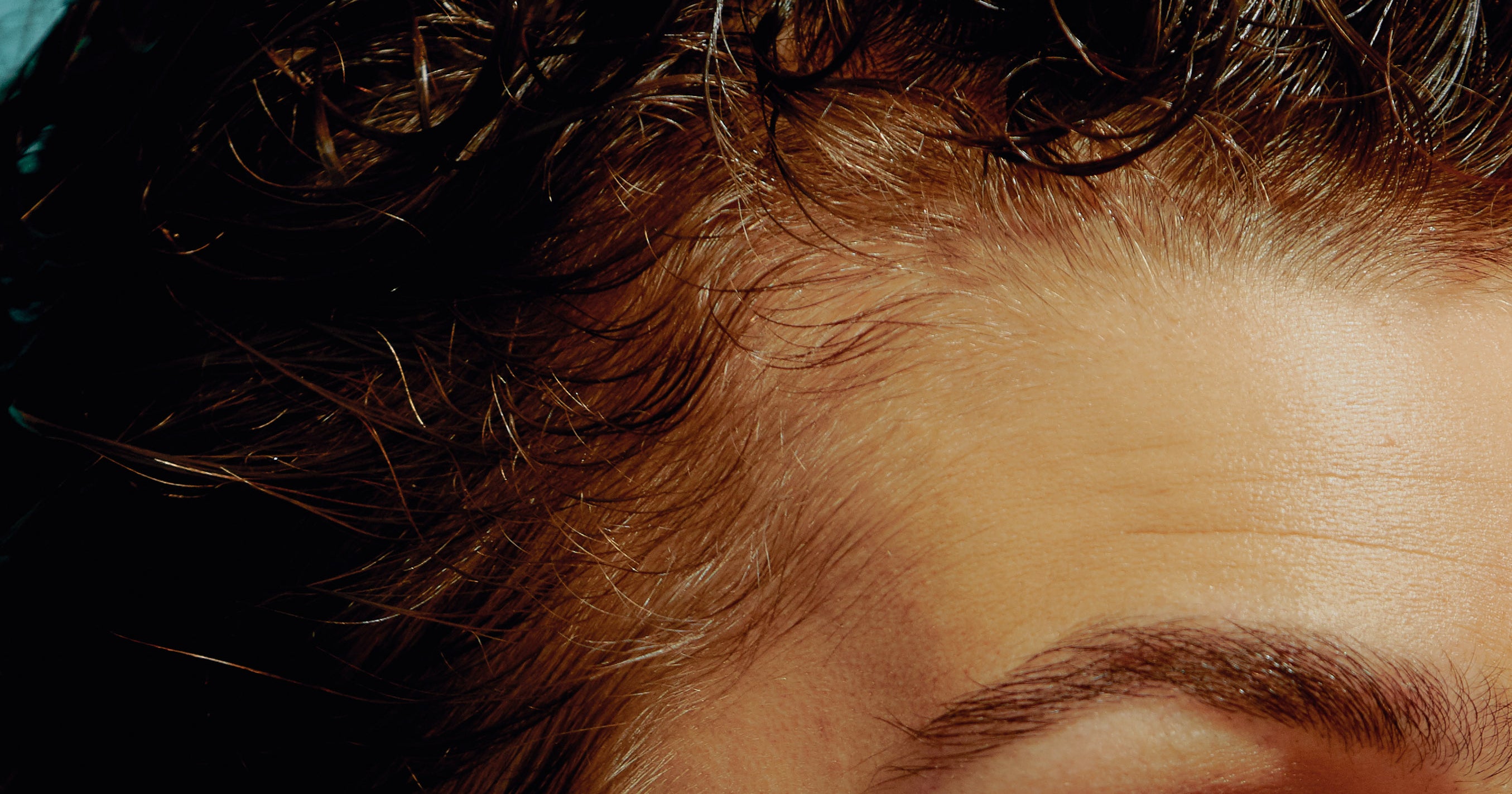 Greasy Hair Guide Products To Prevent & Fix Oily Scalp