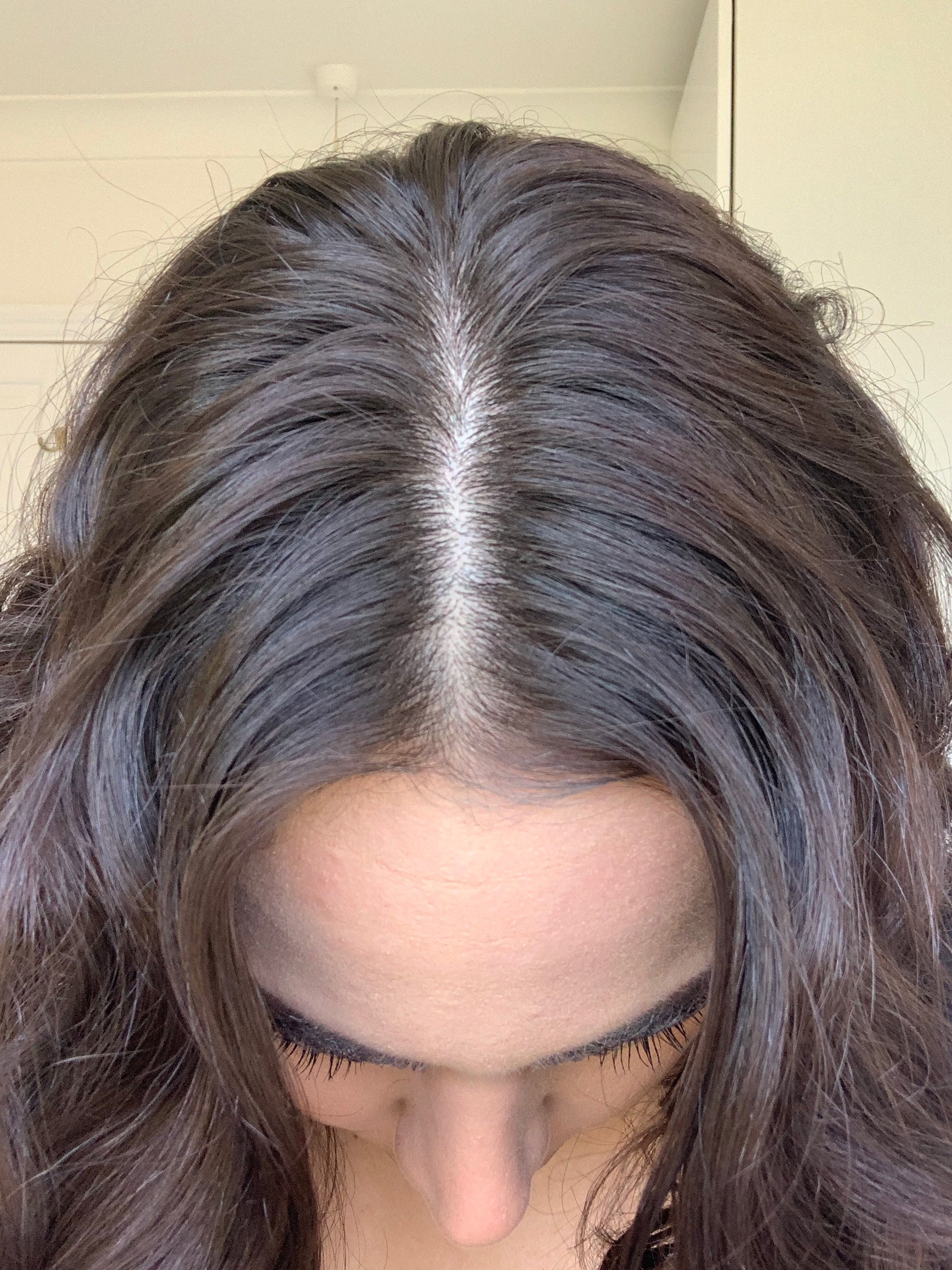 I Tried TikTok's Glycolic Acid Dandruff Hack & It Works