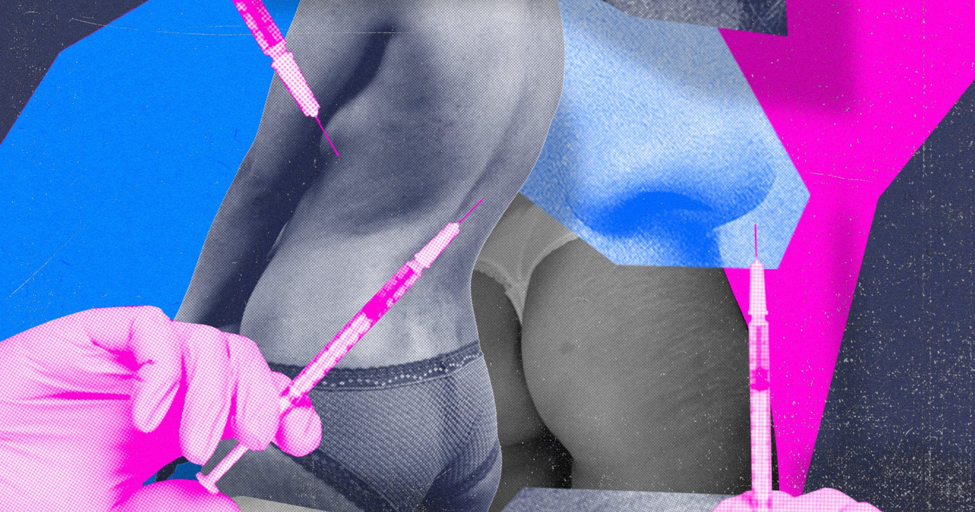 Why Are Requests For Plastic Surgery Reversals On The Rise? 1 Why Are Requests For Plastic Surgery Reversals On The Rise?