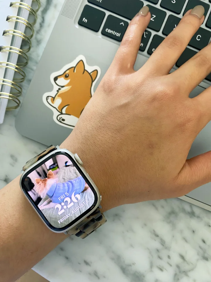 Is the series 7 watch worth it Clearance