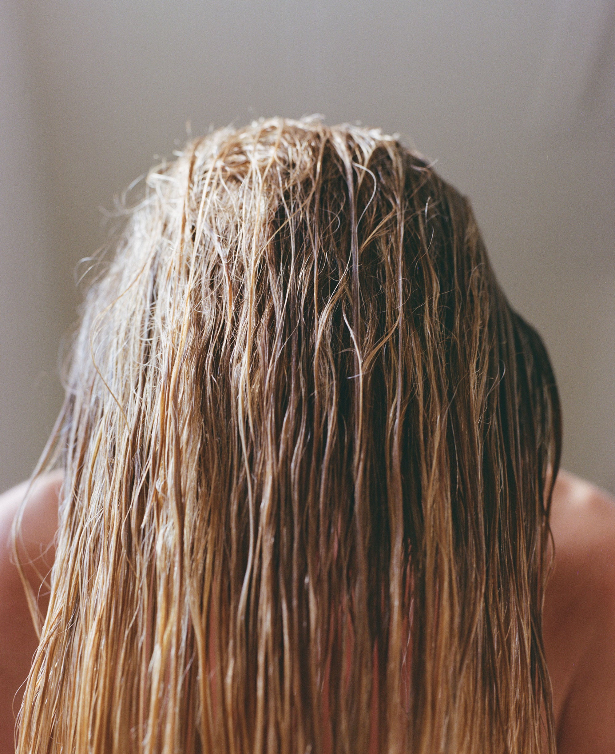 Hair Masks Didn't Fix My Hair Loss Because It Was PTSD Hair Masks Didn't Fix My Hair Loss Because It Was PTSD