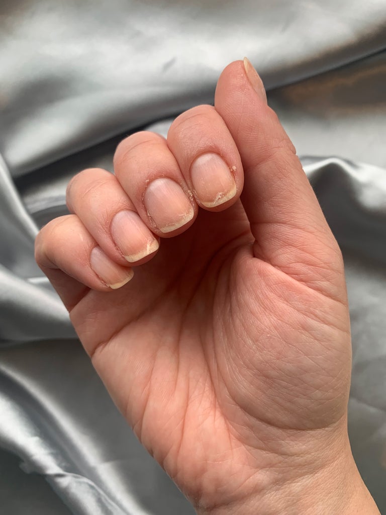 TikTok’s Nail Exfoliation Is Just The Thing For Flaky, Weak Nails