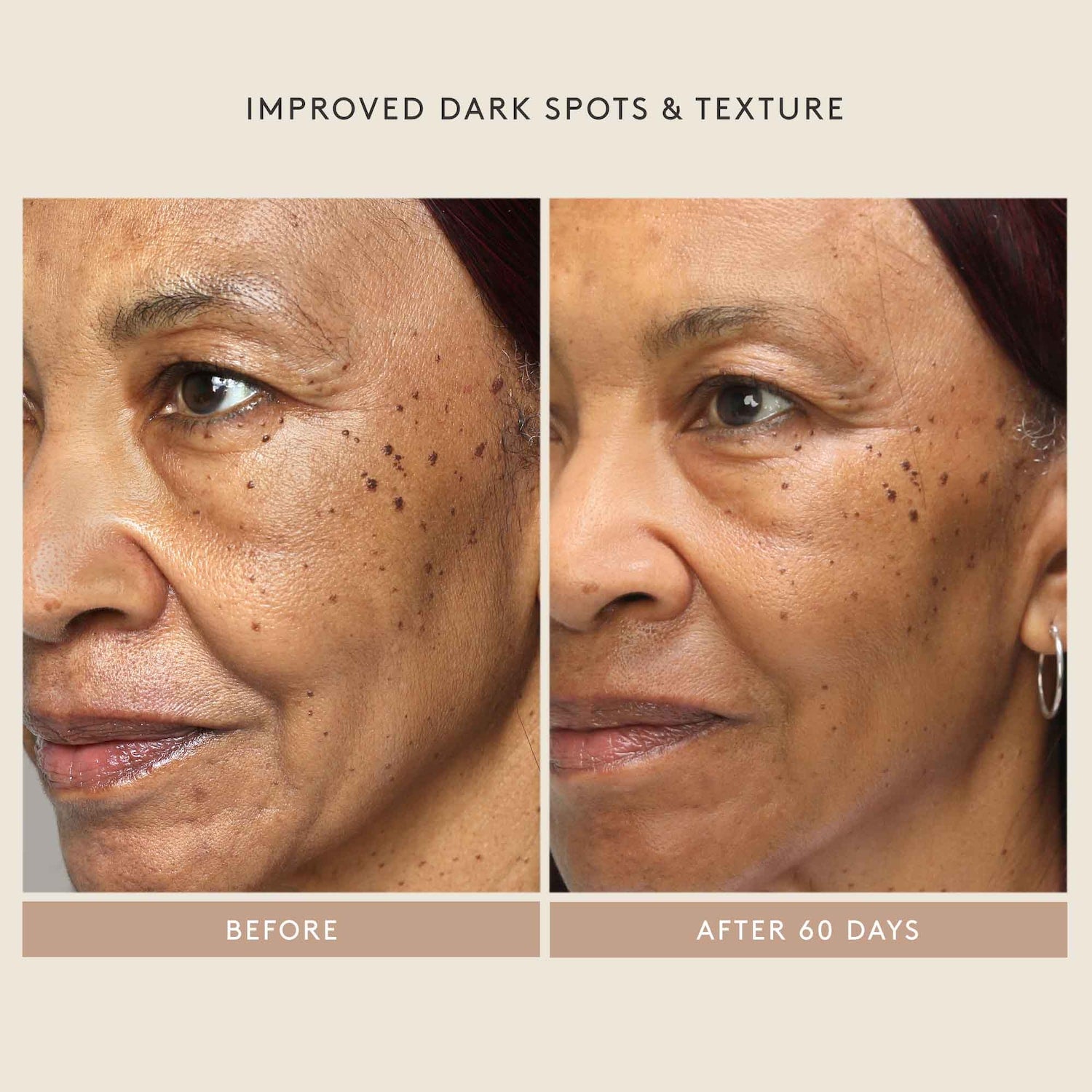 Shani darden retinol shop reform