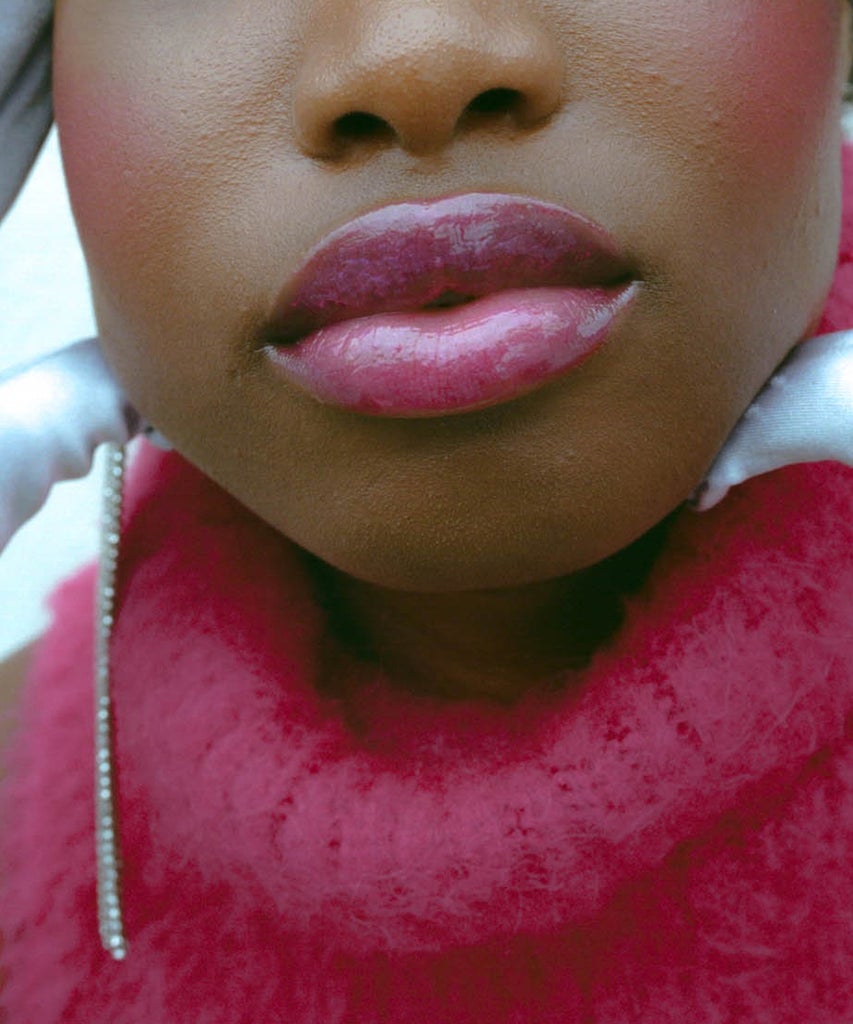 Black Women Get Fillers Too — & I Refuse To Dissolve Mine