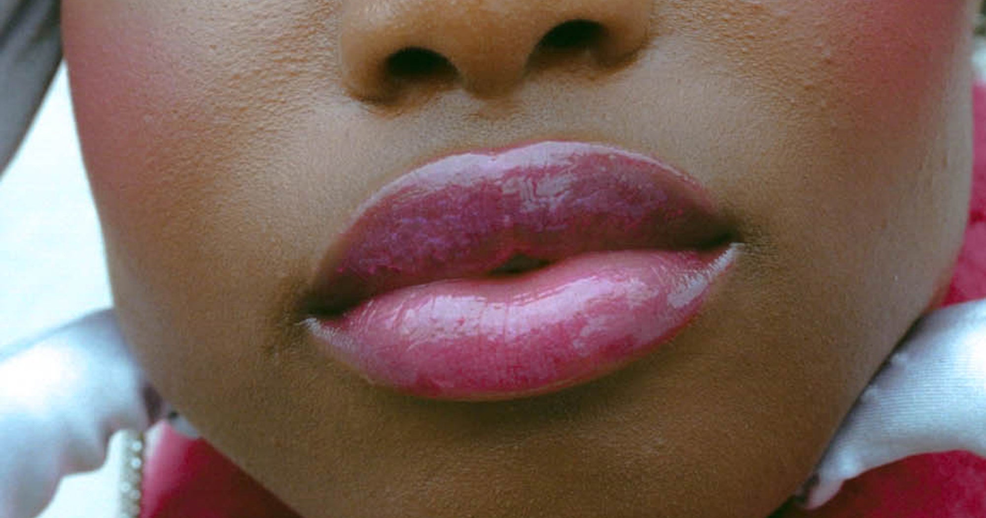 Black Women Get Fillers Too — & I Refuse To Dissolve Mine