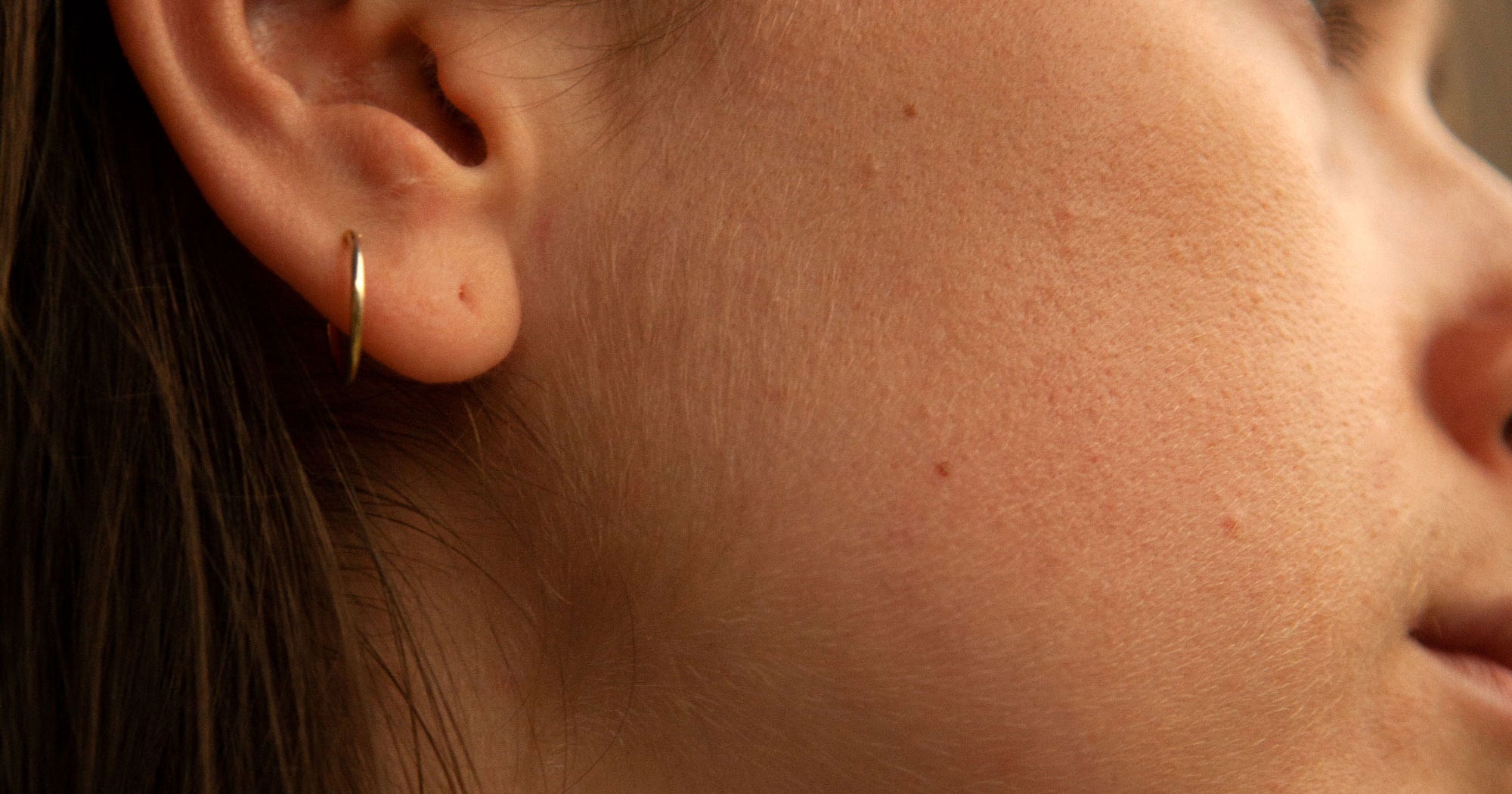 Vaping Is Wreaking Havoc On Skin