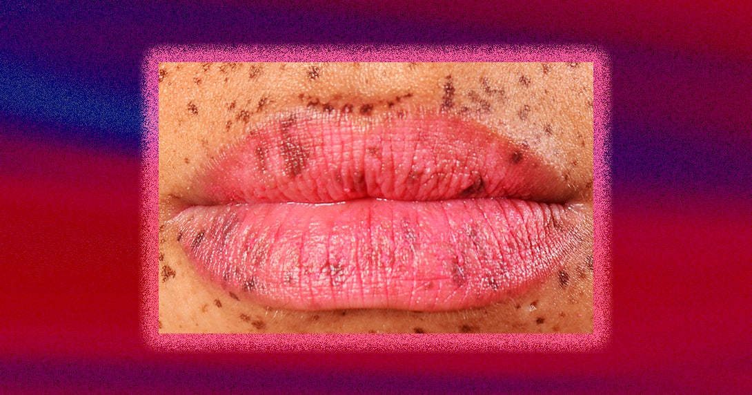 Mental Health Checks Before Cosmetic Surgery Is Coming mental-health-checks-before-cosmetic-surgery-is-coming