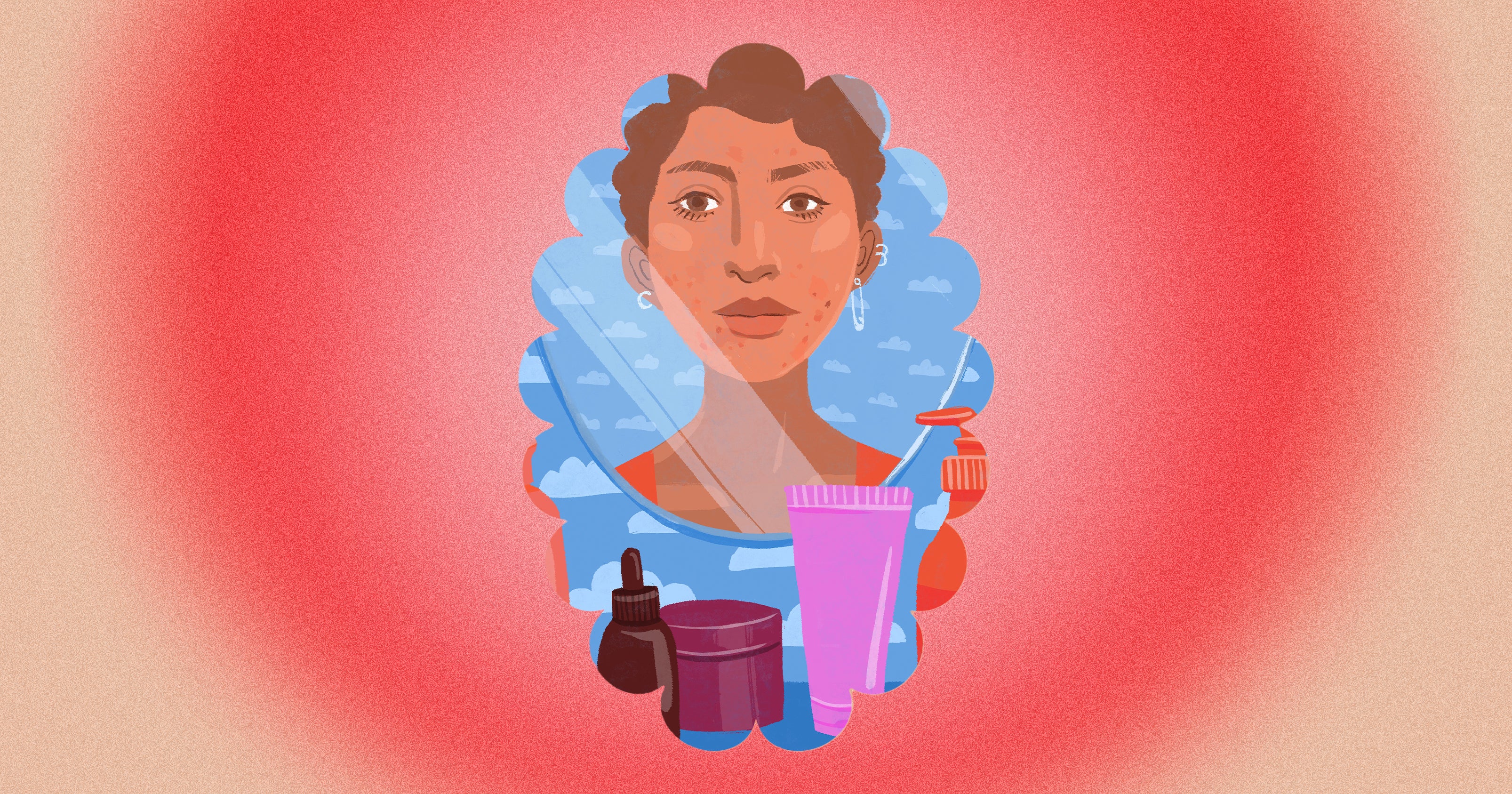 Welcome To Refinery29’s Acne Files!