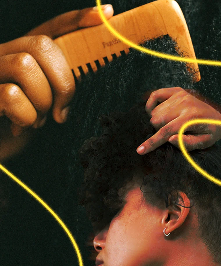 Am I Tenderheaded, Or Is My Scalp Just Sensitive?