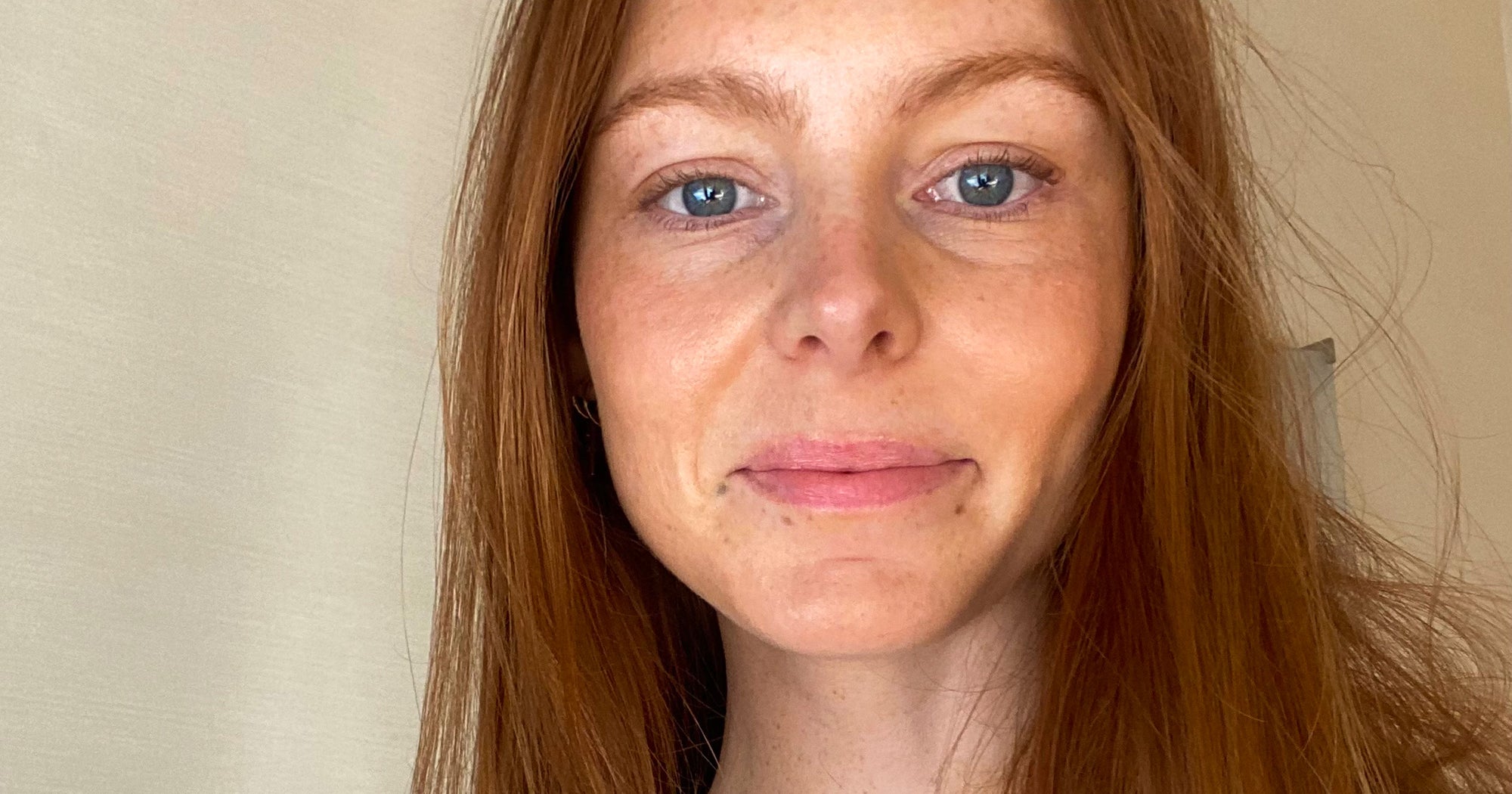 I Was Scared Clear + Brilliant Would Zap My Freckles — But I Did It Anyway