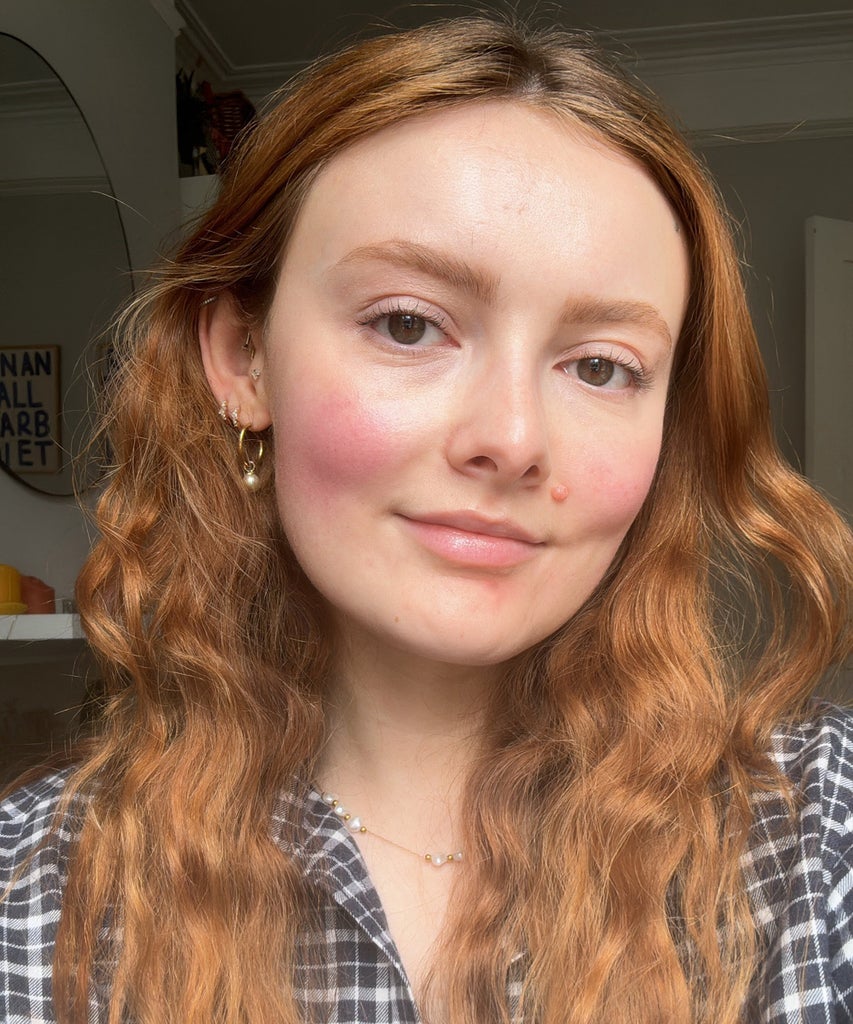 Is My Sex Life Making My Rosacea Worse?