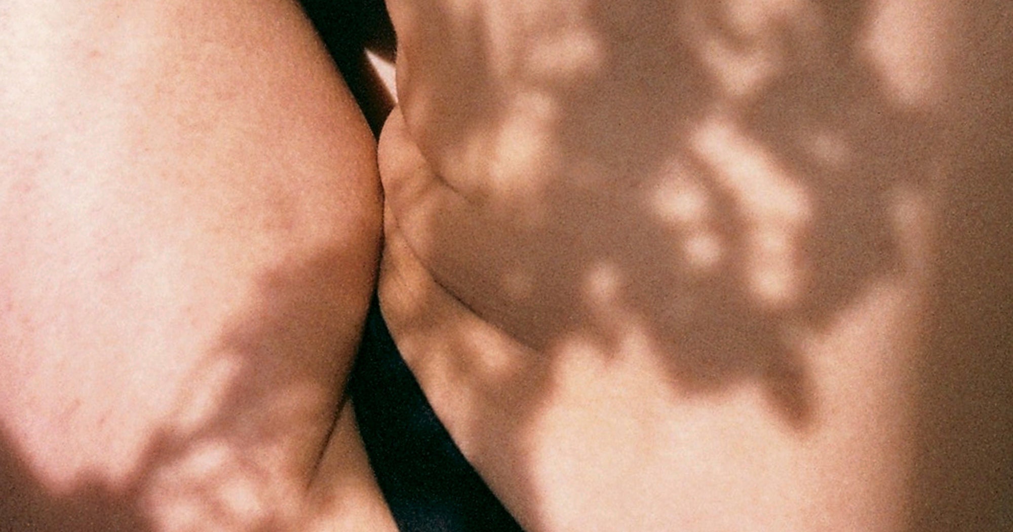 Endometriosis Could Be Linked To Trauma, Actually