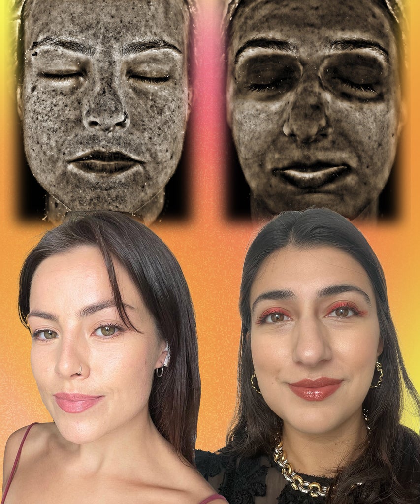 How Much Sun Damage Does Team Refinery29 Have? We Found Out