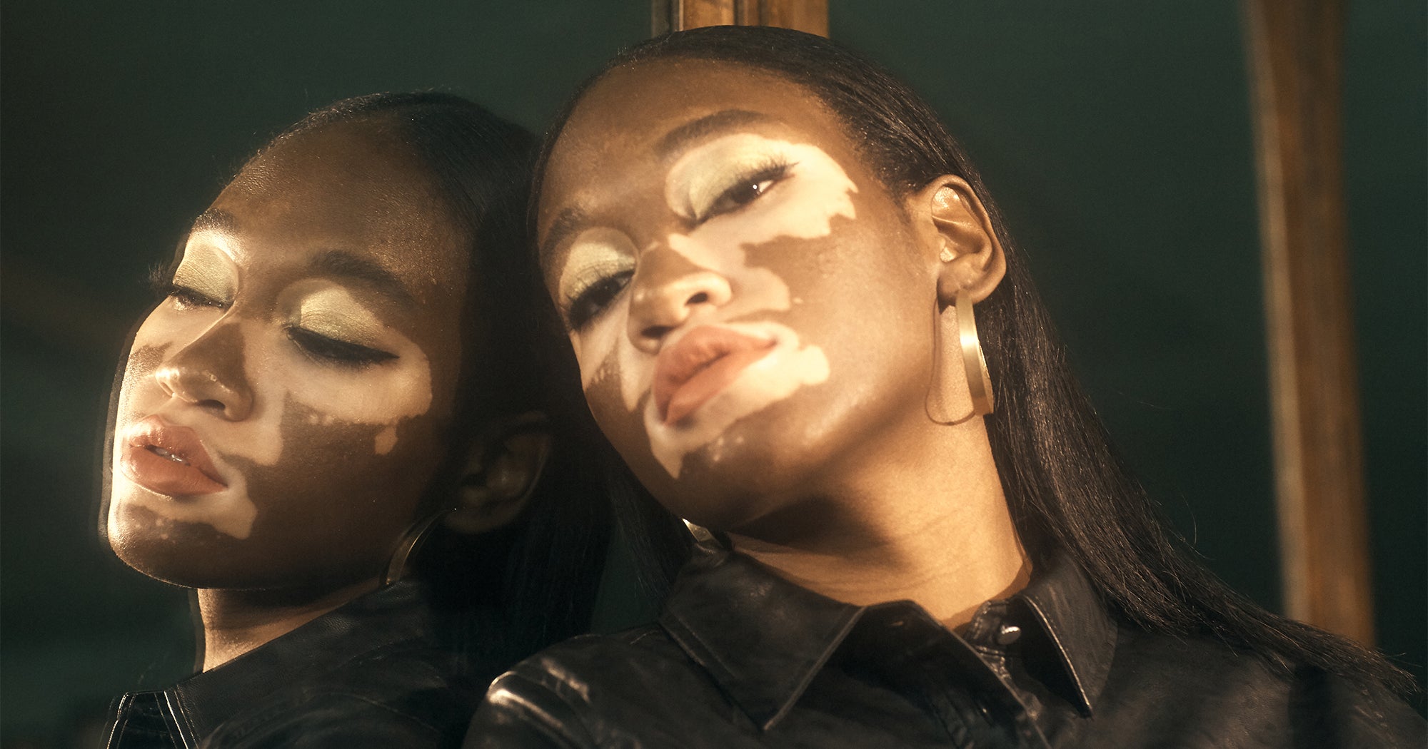 I Used To Cover My Vitiligo With Makeup — Now I Celebrate My Skin