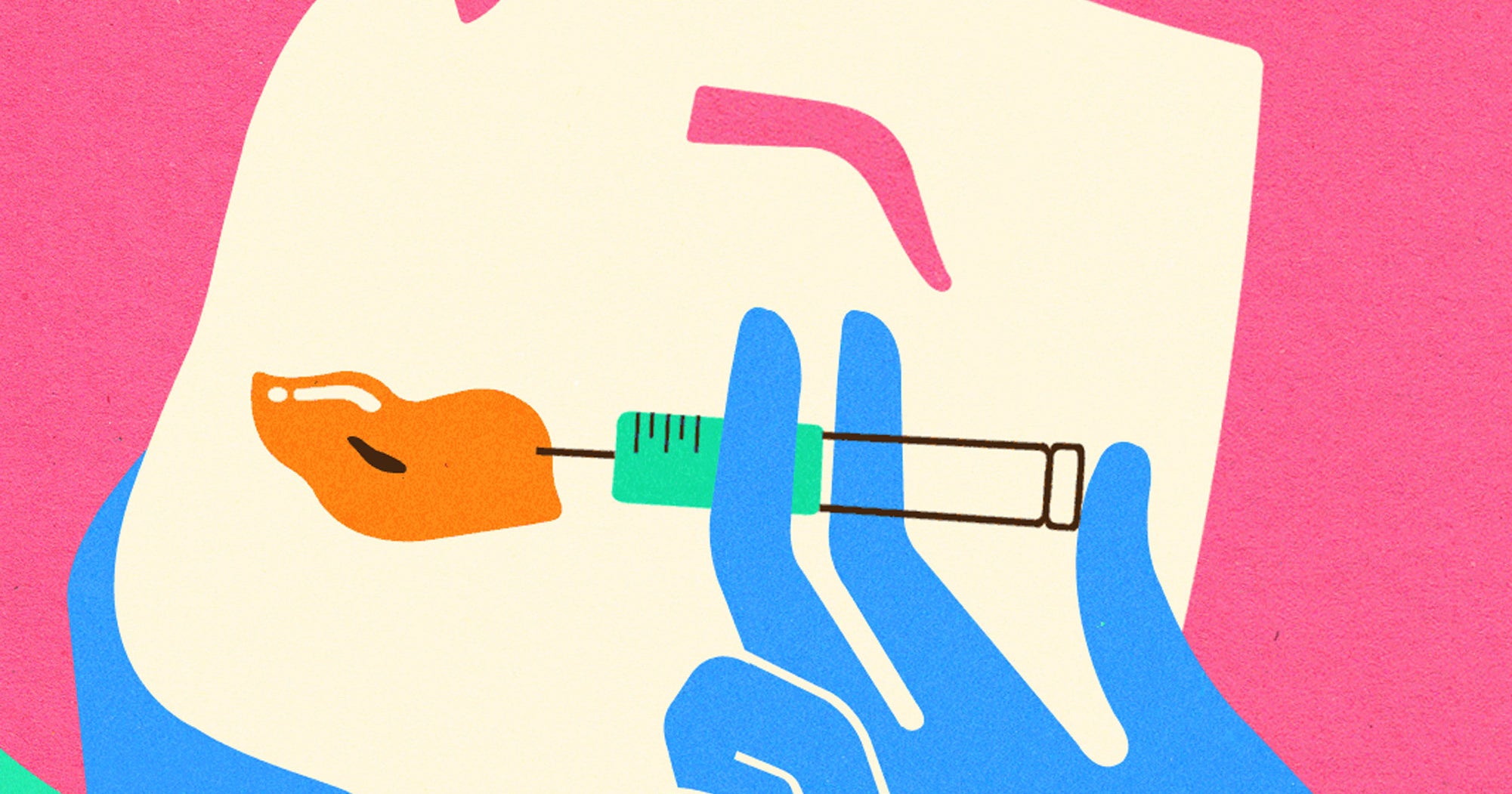 Lip Filler Procedure Cost, Expert Information