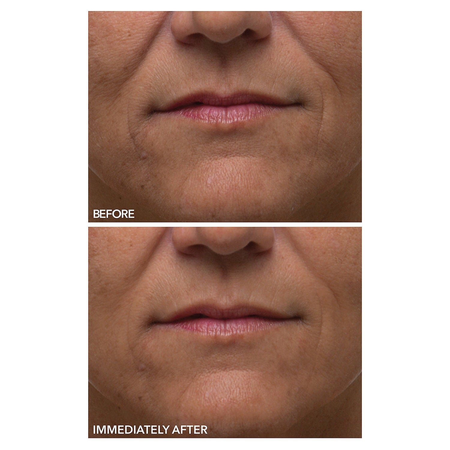 dr dennis gross daily peel