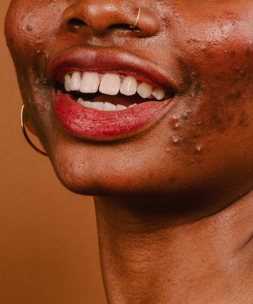 Should You Still Go To The Dentist During COVID-19? Dentist COVID-19,