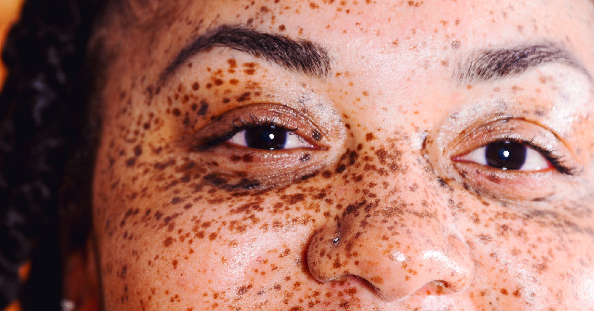8. How to Enhance Your Freckles and Blonde Hair Naturally - wide 1