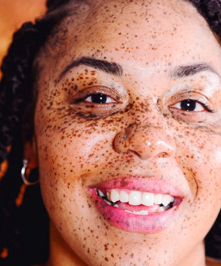 Makeup Tips Tricks To Enhance Your Freckles