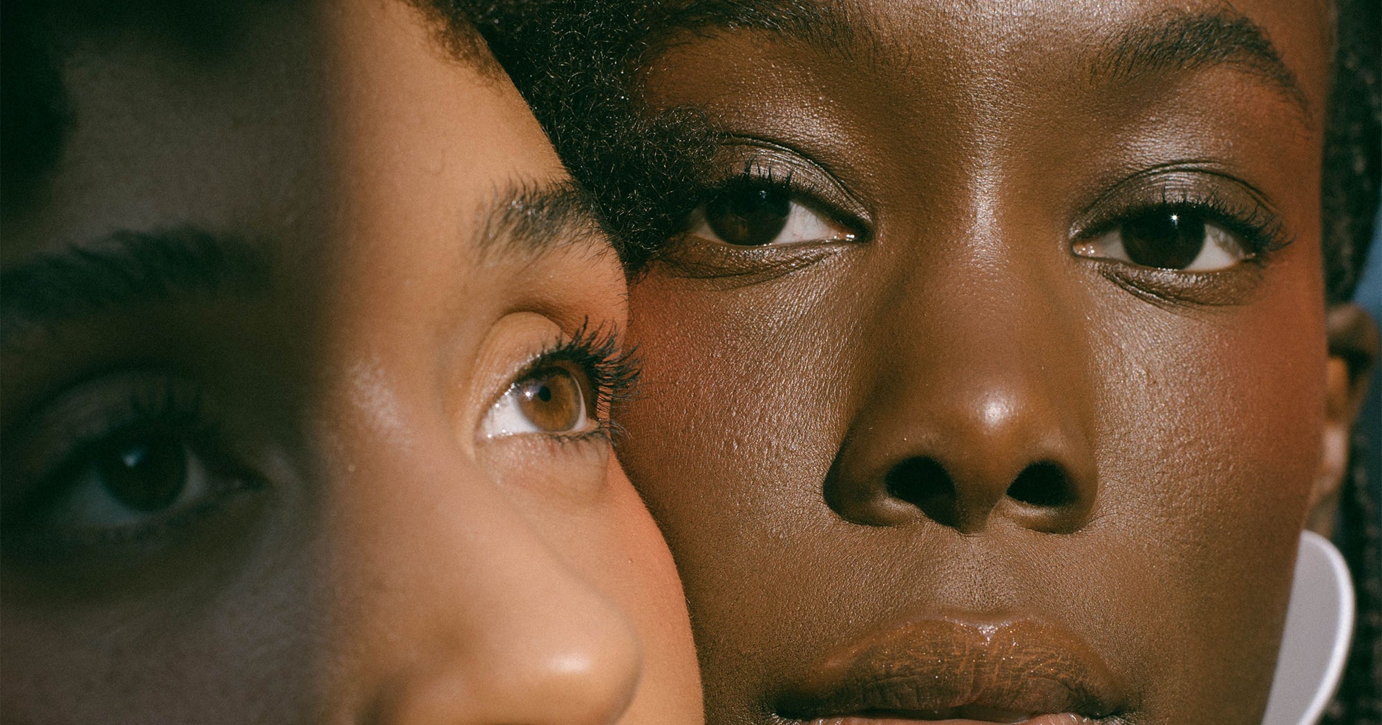 How To Treat Dandruff, Psoriasis, Alopecia In Afro Hair